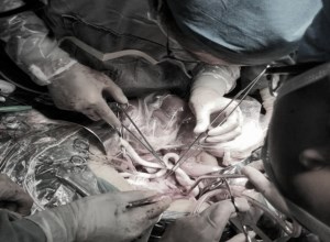 “拆弹专家”｜一例腹主动脉瘤破裂出血患者的生死时速